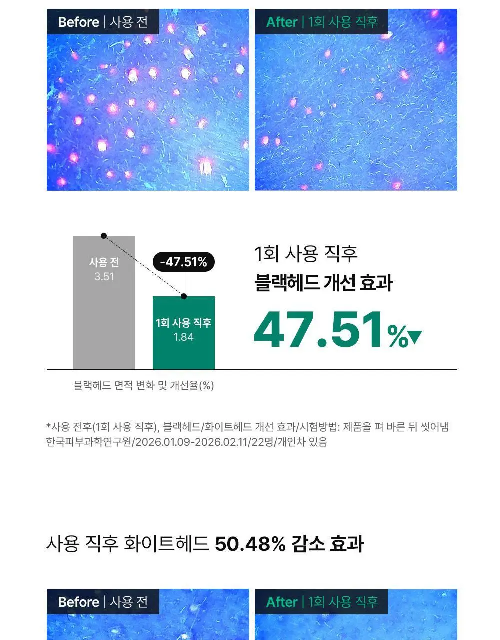[여드름기능성] 동아제약 아크네 프로 겔제 30ml 상세페이지 12